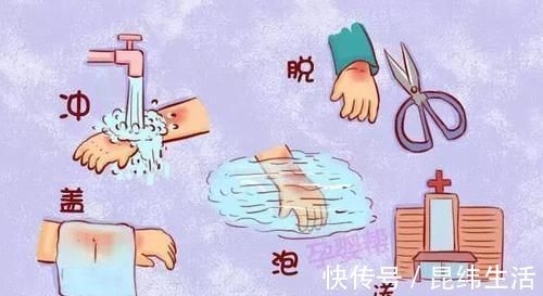 湿润状|孩子烫伤以后,要马上去医院吗?不是,这样会更严重