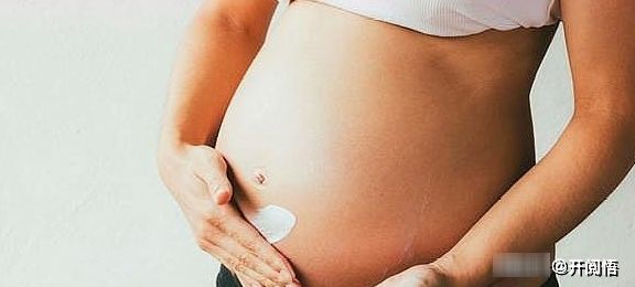 美国运动医学协会|怀孕后如何预防妊娠纹？孕期做好这3件小事情，赶走“花纹肚”