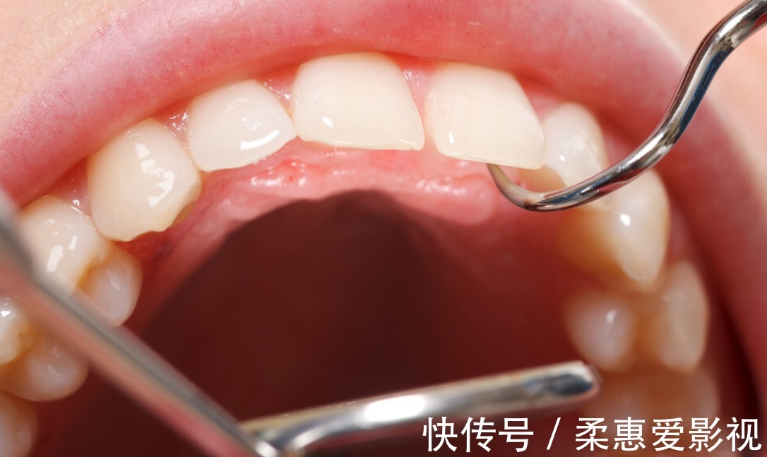 症状|糖尿病注意:这4个不易察觉的症状,也是糖尿病恶化的信号