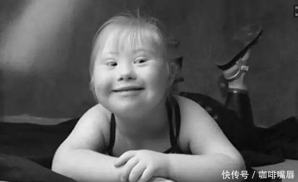 21三体综合症|外国宝妈不顾反对生下“唐氏宝宝”,网友坦言:都有一个共同点!