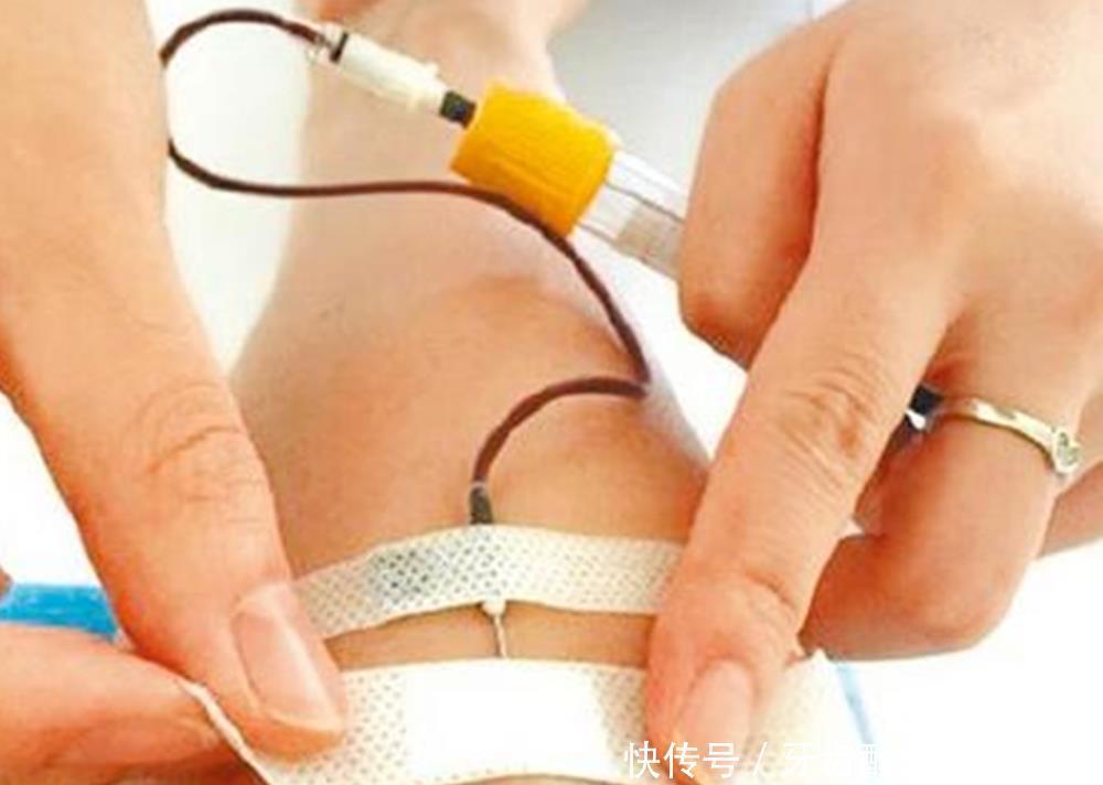 妈妈|一个孕期下来,孕妇要抽多少管“血”?过来人:血管都“干瘪”了