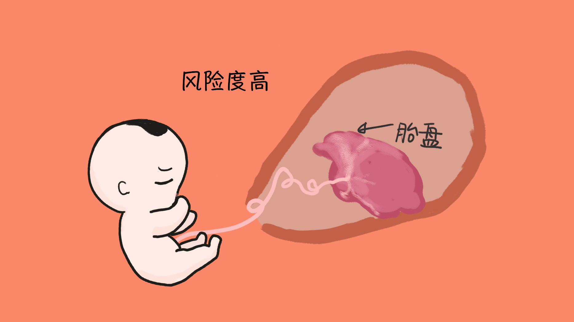 诞下|妈妈异卵四胞胎,诞下双儿双女,网友“异卵四生,太幸运了!”