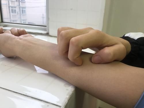 皮肤瘙痒|若体内血糖超标了,身体这2处会有瘙痒的表现,别忽视