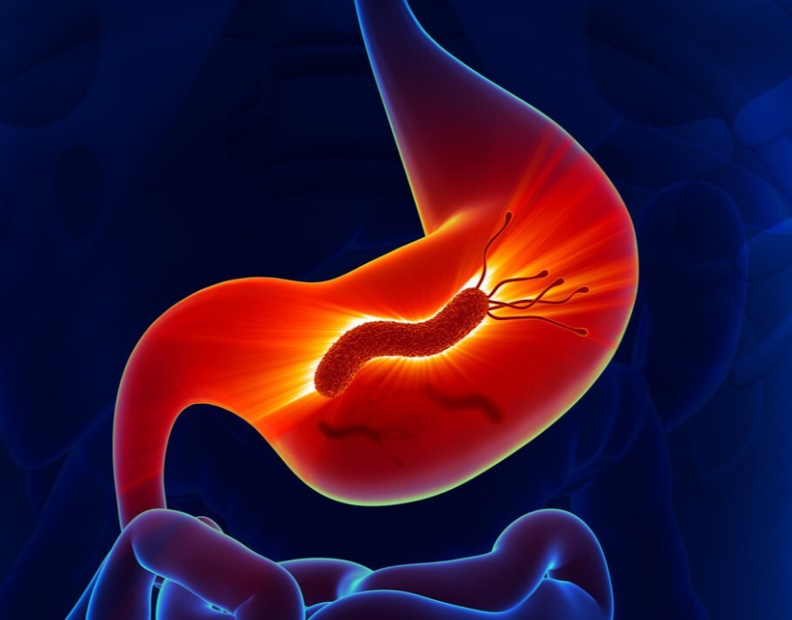 蔓越莓|57岁大叔身患胃癌,半年后复查,癌细胞消失了,究竟怎么回事