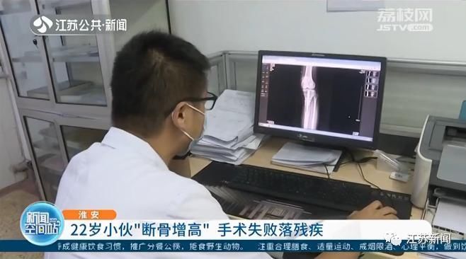 身高不足1米8,自卑小伙到国外“断骨增高”,结