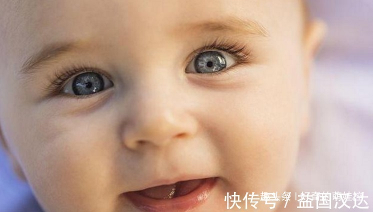 你好漂亮|有一种病叫“孩子太漂亮”,天生自带眼妆,是产检查不出的罕见病