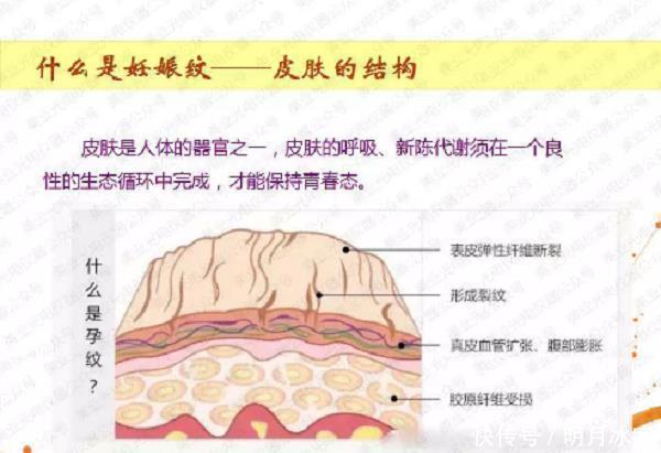 拉伸|两闺蜜同时怀孕,掀开衣服看到肚子时,对比太扎心了