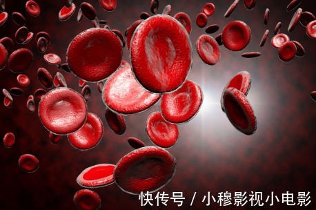 中老年人|高血脂的“源头”已发现，喝酒没上榜，这个大家几乎都在吃