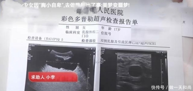 “这样显腰细”!17岁女孩嫌弃自己去整形,结果让美梦变“噩梦”