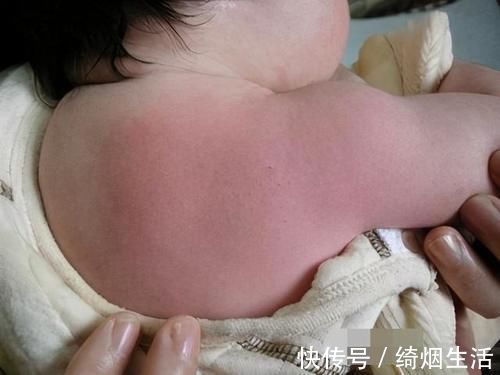 宝妈|宝宝夜里哭闹不止,用梳子刮一刮就好了?别让你的无知“害了”娃