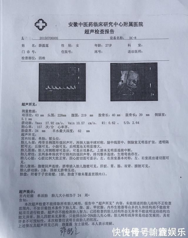 胎儿|孕期要做四维彩超,四维彩超的这些误区和认识,孕妈妈早知道早好