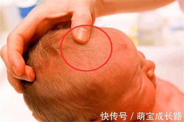 开十指|为什么动物生育后代那么轻松,人类分娩时却疼得撕心裂肺?