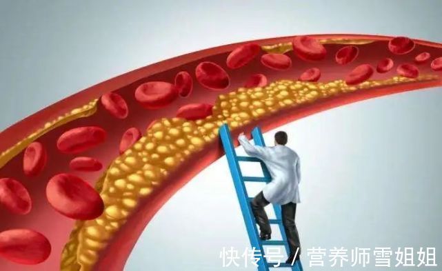 超标|一旦出现4种迹象,说明血脂“超标”了,需给血管“洗洗澡”了