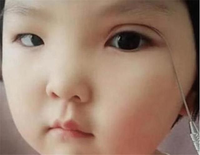 宝妈|孩子不是双眼皮,家长亲自给整成双眼皮,网友:无知
