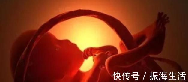 脐带|孕妈身体有这个“感觉”,别认为是好事,可能是宝宝“脐带绕颈”