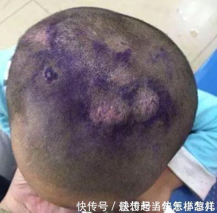 奶奶|4岁孙子睡觉总捂着头,奶奶半夜扒开头发,忍不住掉下眼泪