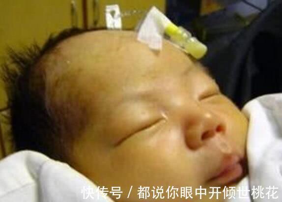 酸性|孩子出生后出现黄疸,多半是孕期时的坏习惯导致,要留心!