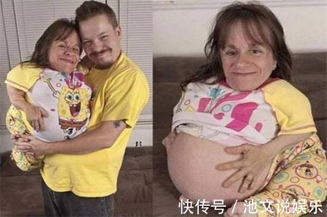 斯泰茜·赫勒尔德|“袖珍女孩”意外收获1米9丈夫,生下2个混血儿,如今又怀上了