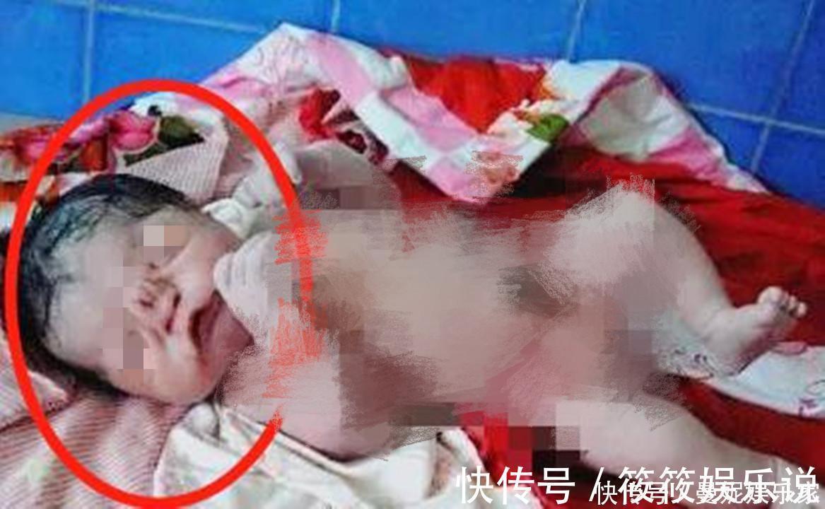 高龄|高龄产妇生下“猪八戒”宝宝，丈夫不想抚养，医生的解释挽救了娃