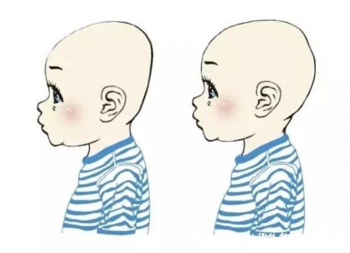 小孩|为什么中国小孩多是“扁头”,而美国小孩是“圆头”家长别忽视