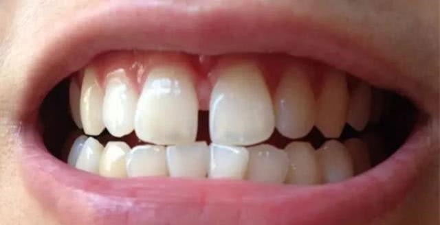 身体衰老|女性开始衰老,有3处变长,1处变圆,若一个不占,说明还年轻