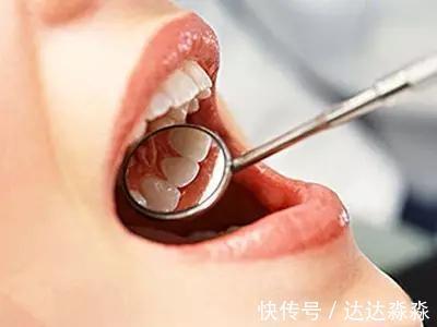 混合痔|老中医口口相传的13种常见病应对秘方