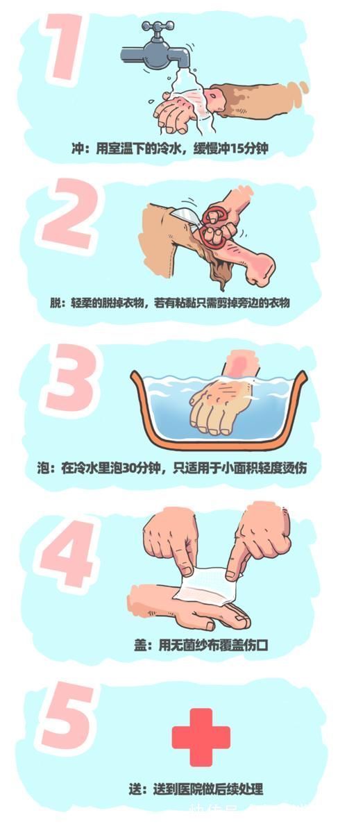 水龙头|孩子被烫伤怎么办?父母学会这4个急救步骤,连医生都会称赞