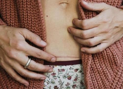 小林|“宁愿肚皮挨刀也不顺产”,二胎宝妈说出心里话,好处再多也不选