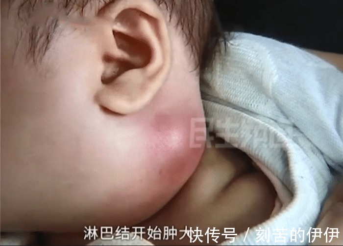 一家人|1岁宝宝患罕见病 大宝2岁因此病去世 母亲说出原因深深自责