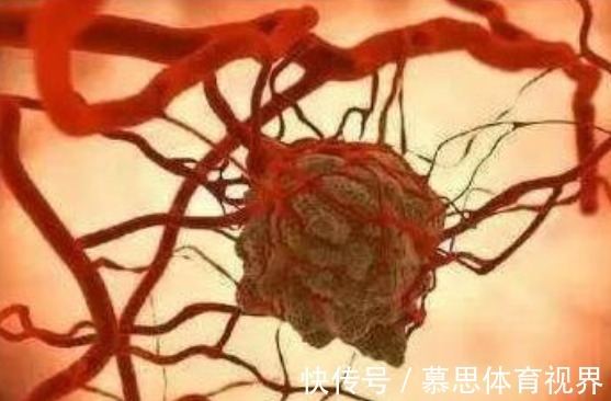 酸度|碱性体质的人，离癌症很远！7类常见食物属于碱性，为健康多吃