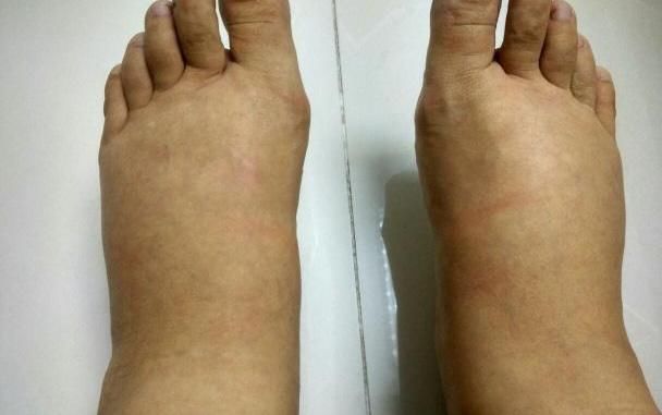  男人|男人早上起床时，如果身体有5种表现，可能是肾“负担”太重了