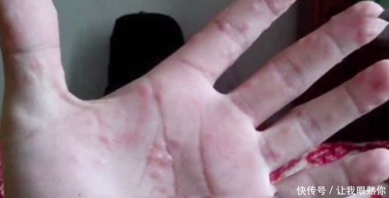 会“咬人”的树,谁见了也得绕道走,专家:值钱!