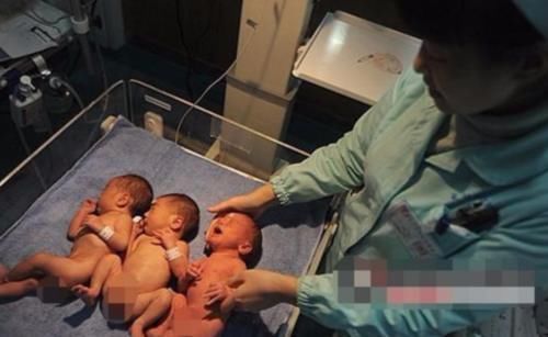 检查|50岁孕妈怀了三胞胎，孩子出生懵了之后就痛哭，让医生也尴尬不已
