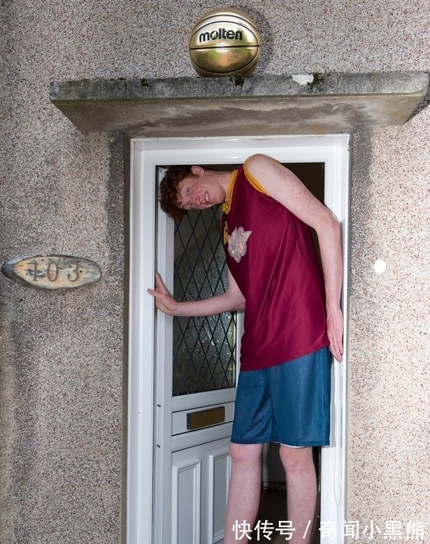 19岁男孩身高2米24称还想再长高点,他两个