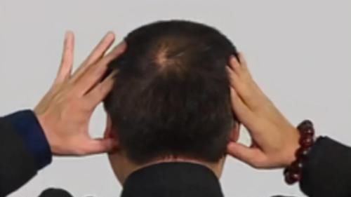  胰腺|耳后有个“降糖窝”，每天按一按，降血糖，刺激胰腺，预防并发症