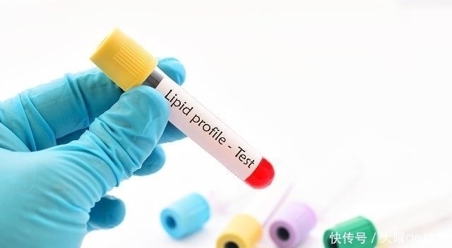 体内“血脂”高？3样“东西”尽量少碰，血栓可能躲着你