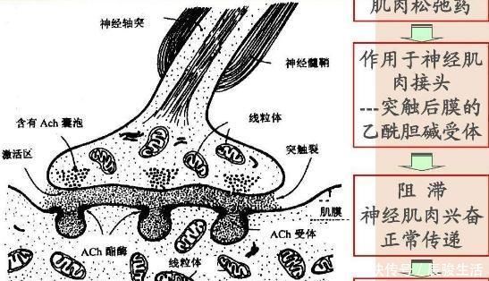 手术时全身麻醉后，人怎样醒过来，麻醉为何会使有的人身体没知觉