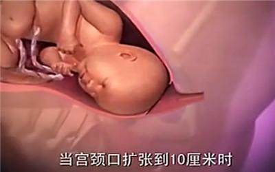 胎头那么大,到底是怎样从那么小的口出来顺产分娩全过程-附图
