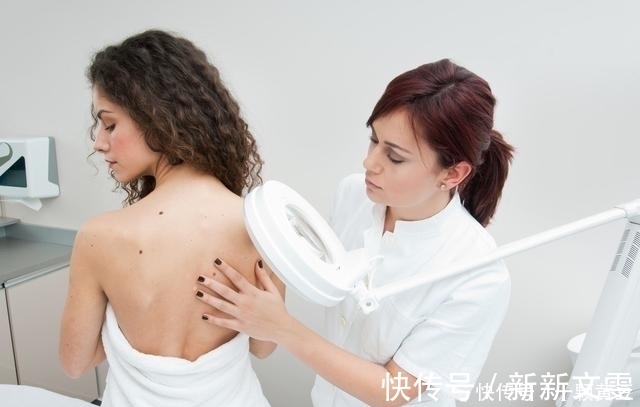 斑痣|身上长这2种痣时，需引起重视，以免危害健康