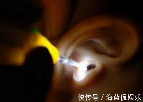 堪称教科书|2岁宝宝半夜耳朵进虫,奶奶用一招救了娃,医生堪称教科书典范
