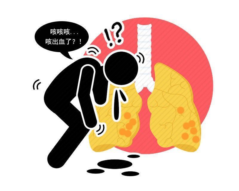 烟草|国际肺癌日:肺内有癌,身上告知?若出现3个迹象,最好做下检查