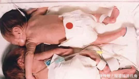 长幼|先出生的不一定是老大双胞胎定长幼,有一种叫“老二的逆袭”