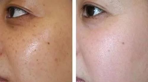 皮肤状态|女性衰老时，出现的小信号，要提前“警惕”，尤其是更年期的女人