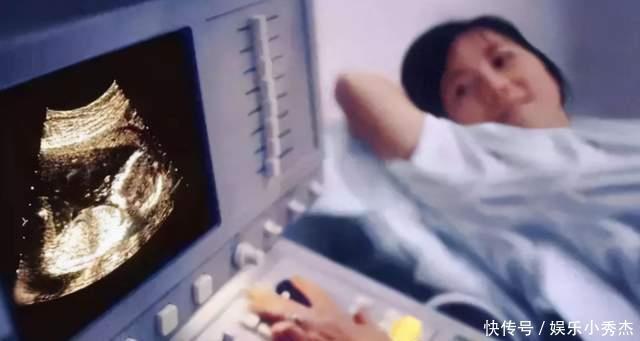 分娩|孕妇产检被告知是“连体畸形儿”，顿时紧张大哭，医生看了却笑了