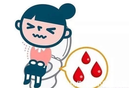 便血|谁说痔疮只能手术了,专家告诉你:喝茶也有用