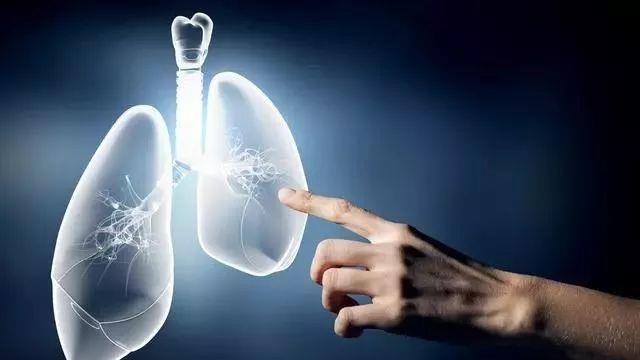 医生实话实说：预防肺结节有6个秘诀，请“照顾