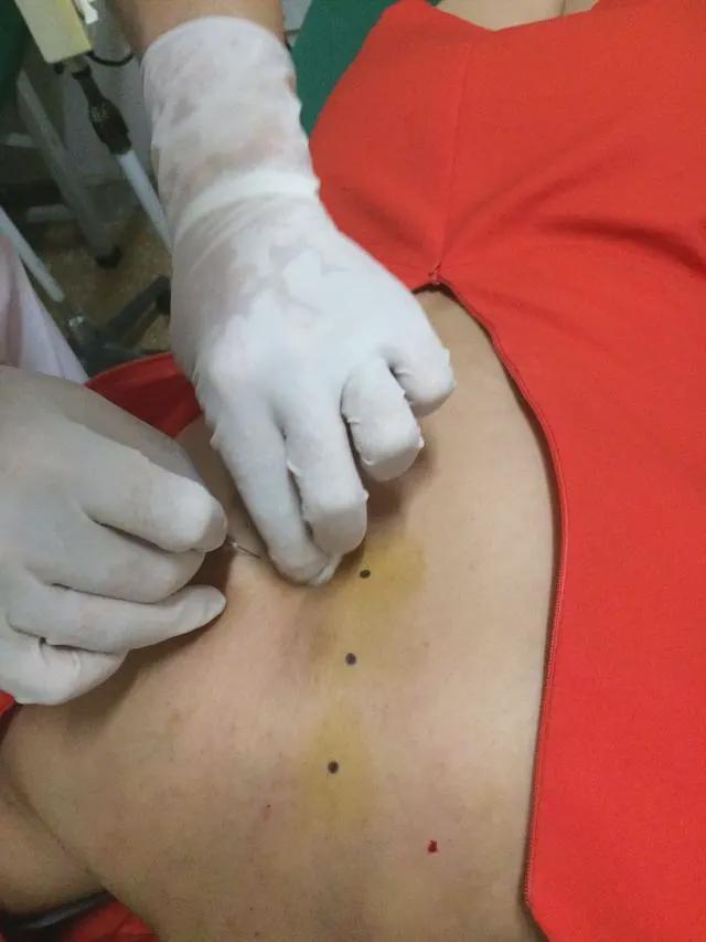 孩子|妈妈拼了!给孩子打生长激素、脊椎埋线花了18万,回头一看全是坑