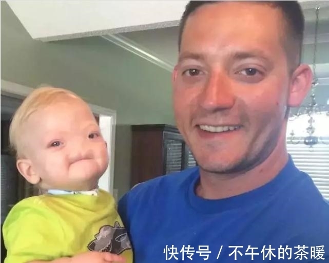 一生|小男孩天生无鼻,却坚持走完了一生