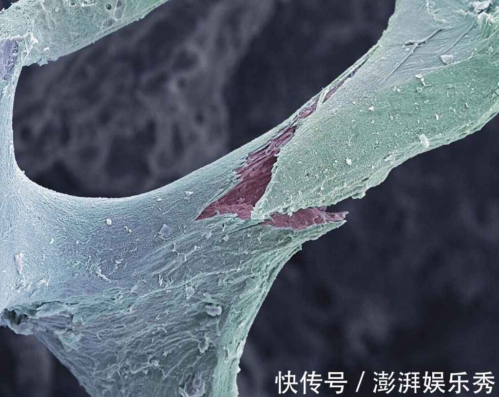 骨质|骨疏松的“加速器”不止核桃，北大院士呼吁：“2黄1白”也要少吃