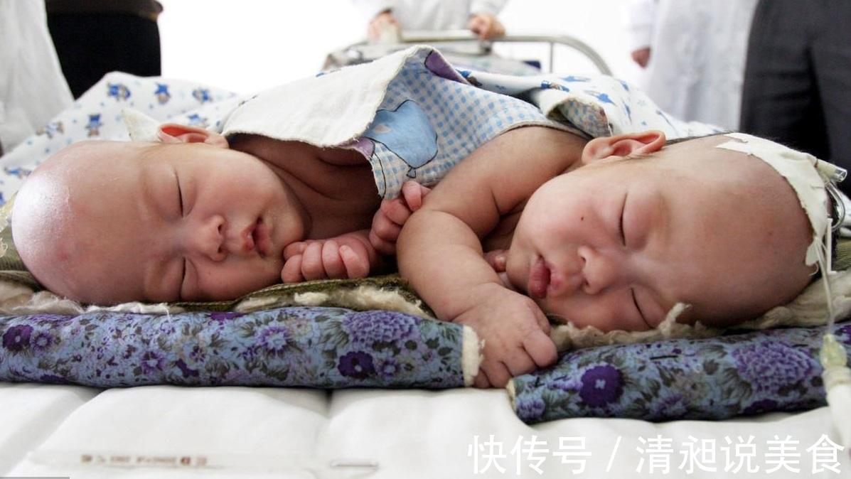 胎儿|宝妈怀了双胞胎全家高兴,生下孩子全家哭成一团,医生太愚昧
